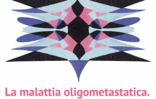 oligometastatica